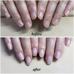 美爪育成before→after